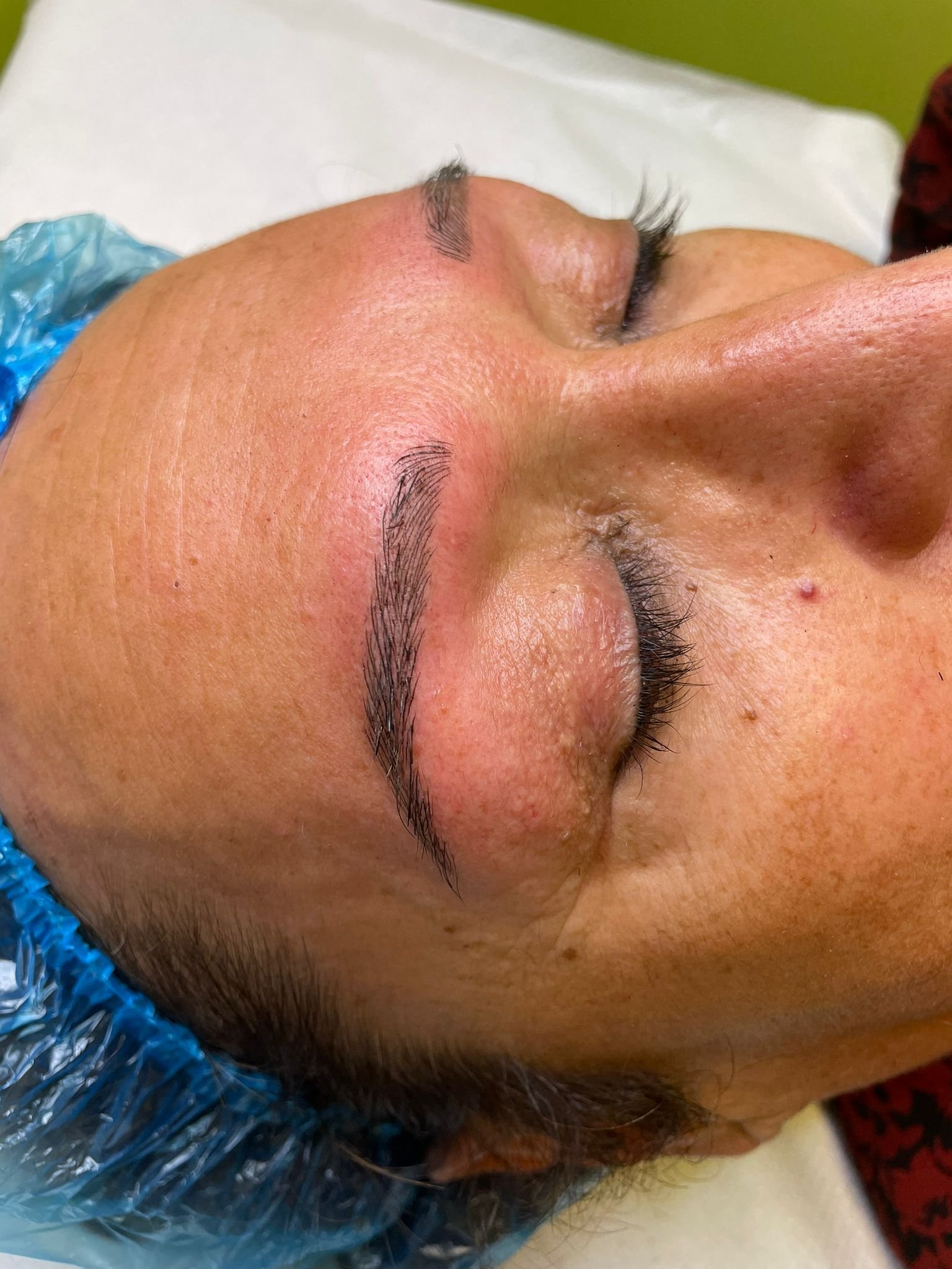Tratamiento Estética 6
